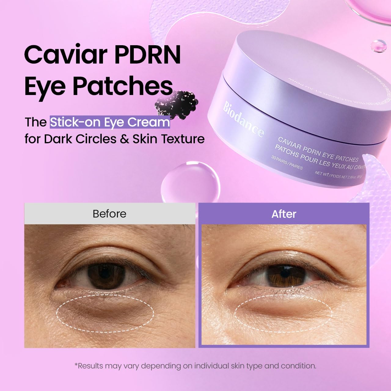 BIODANCE Caviar PDRN Eye Patches, Nourishing Under Eye Patches for Dark Circles, Depuffing Eye Mask for Puffy & Tired Eyes, Travel Essentials & Self Care Gifts for Women, Korean Skin Care (60 Count)